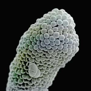  Scanning electron microscope image of stigma (Penta 