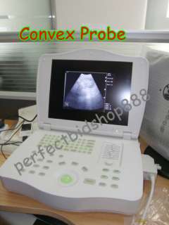 Full Digital Laptop Ultrasound Scanner+Convex/Linear CE  