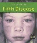 The Fifth Disease (Its Catching)