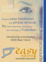 Easy Squeeze blackhead pimple remover extractor acne  