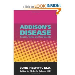  Addisons Disease Causes, Tests, and Treatments 